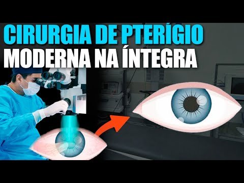 Cirurgia de Pterígio Moderna Completa