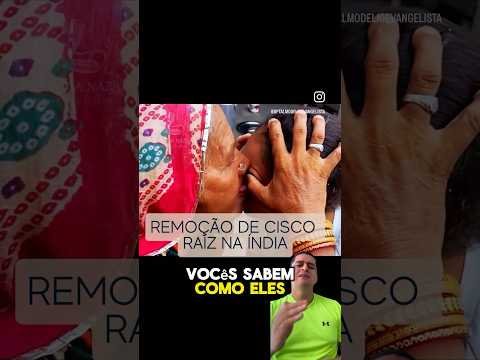 Remoção de cisco do olho raíz na Índia. Teriam coragem? ?#curiosidades #cisco