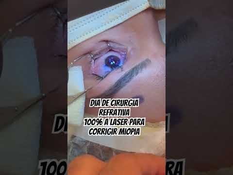Hoje foi dia de cirurgia refrativa para corrigir miopia e astigmatismo. Tem esse sonho ?