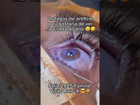 Os fogos de artifício q todo mundo q usa óculos gostaria na virada do ano ?? #refrativa #miopia