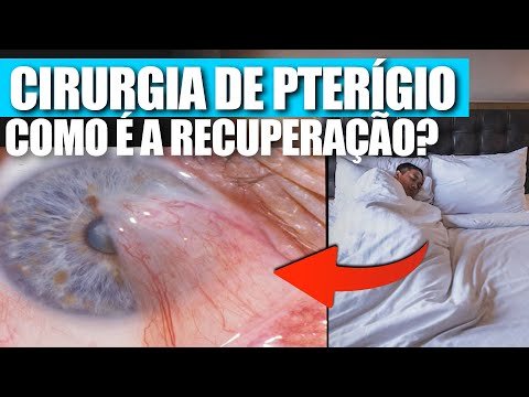 COMO É A RECUPERAÇÃO DA CIRURGIA DE PTERÍGIO?