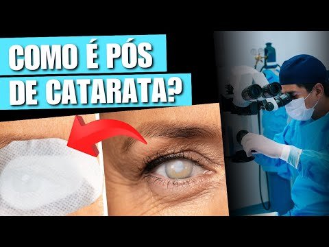 COMO É PÓS-OPERATÓRIO DE CATARATA?