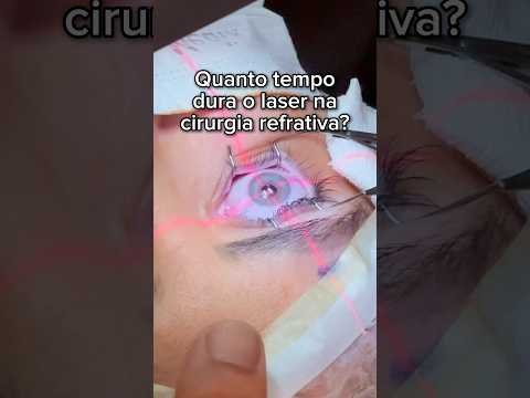 A refrativa 100% a Laser é tão rápida que nem dá tempo de sentir medo 😂😂😂