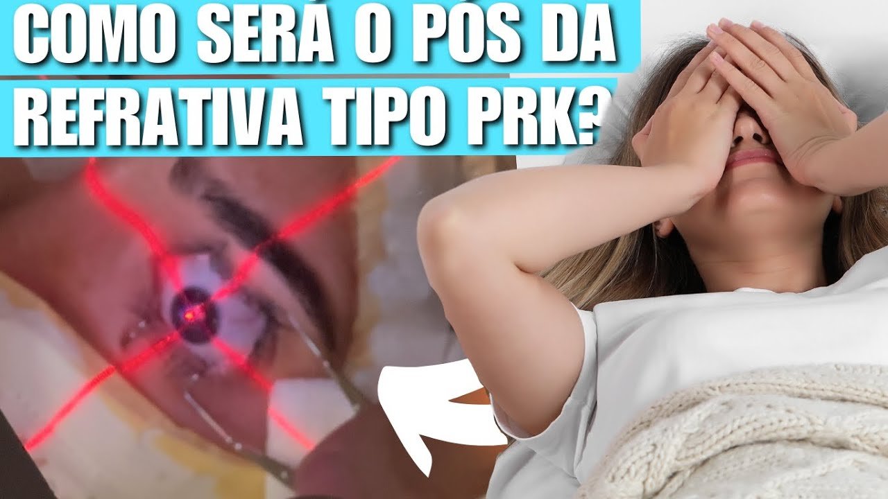 Pós-operatório da Cirurgia Refrativa PRK: Tudo o que Você Precisa Saber