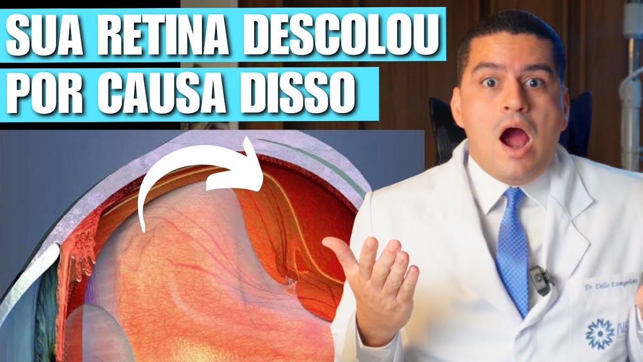 Quais são as causas do descolamento de retina? Entenda os principais motivos