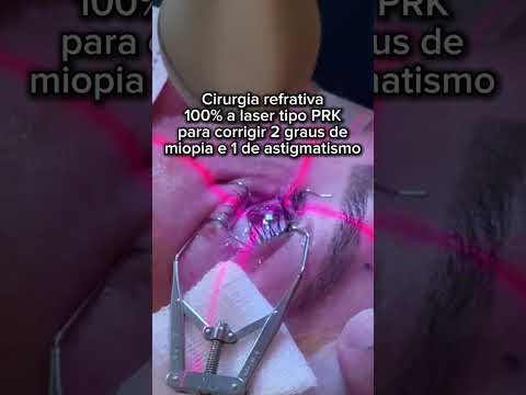 Cirurgia refrativa tipo PRK