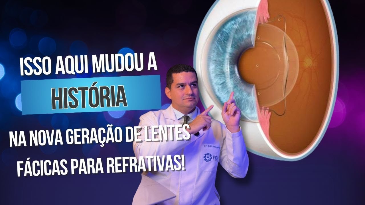 Isso aqui mudou a HISTÓRIA na nova geração de lentes fácicas para refrativas