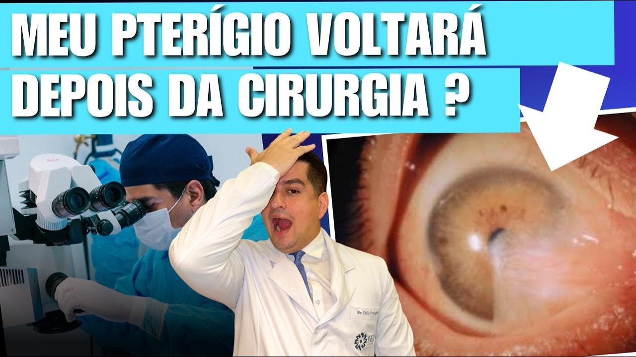 O pterígio pode voltar depois da cirurgia? Entenda os fatores de risco