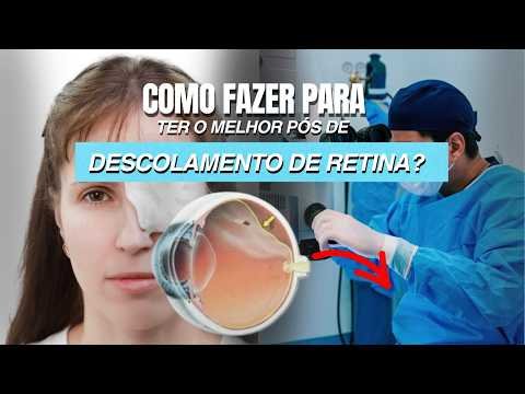 COMO FAZER PARA TER O MELHOR PÓS DE DESCOLAMENTO DE RETINA?
