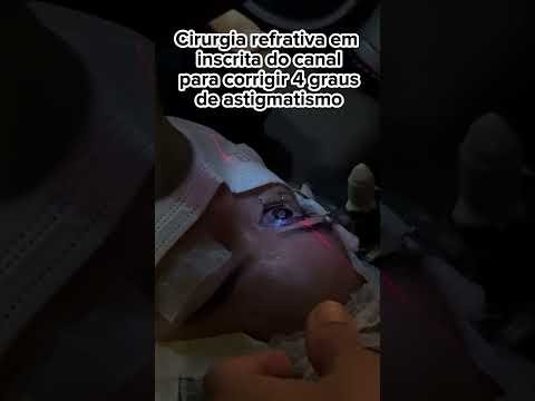 Cirurgia Refrativa para 4 graus de astigmatismo