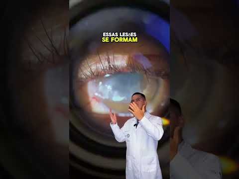 Você dorme de olho aberto? Sabe o que isso pode causar?
