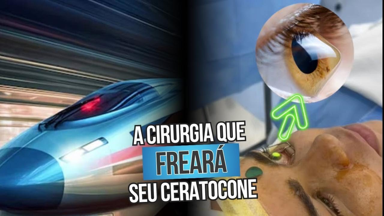 A cirurgia que pode ajudar a frear o ceratocone