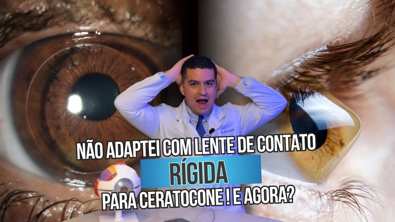 Ainda não tenho idade para cirurgia refrativa: o que fazer agora?