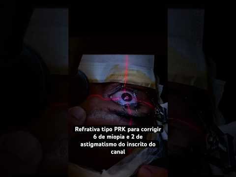 Refrativa tipo PRK: 6 de miopia e 2 de astigmatismo